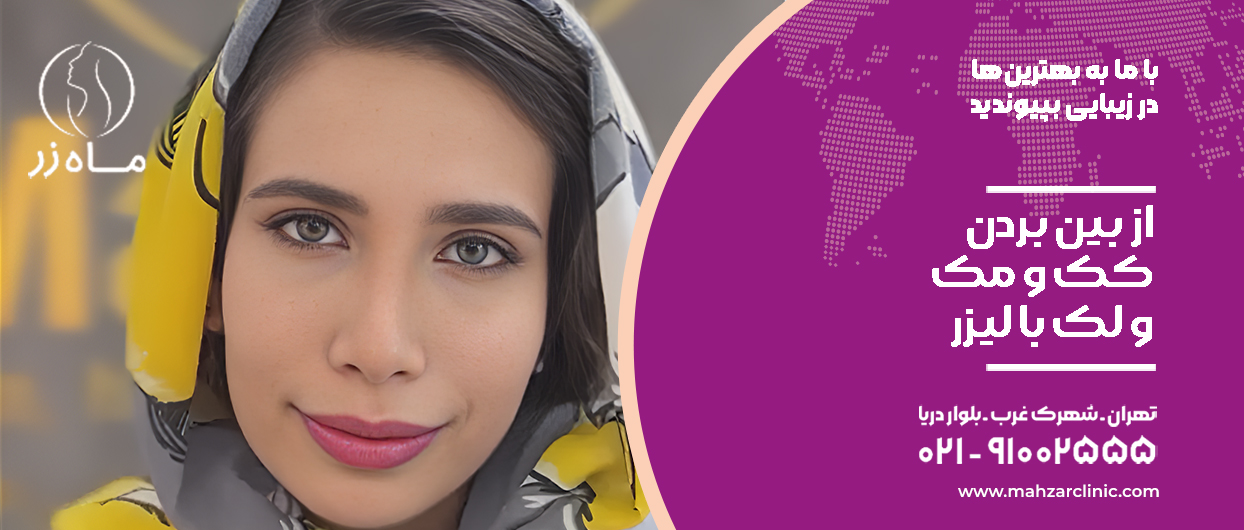 از بین بردن کک و مک و لک با لیزر