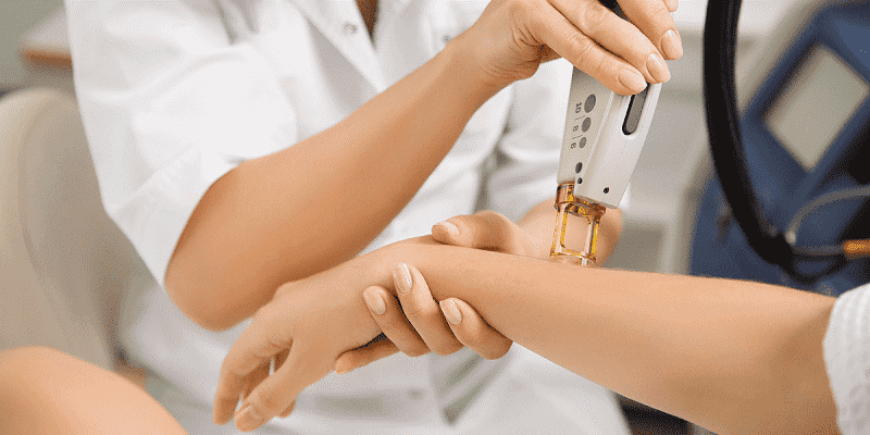 لیزر موهای زائد در پونک