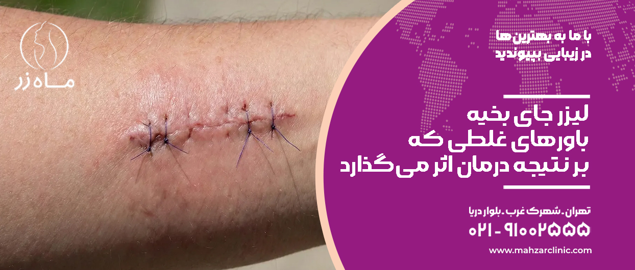 لیزر جای بخیه؛ باورهای غلطی که نتیجه درمان را تحتتأثیر قرار میدهند