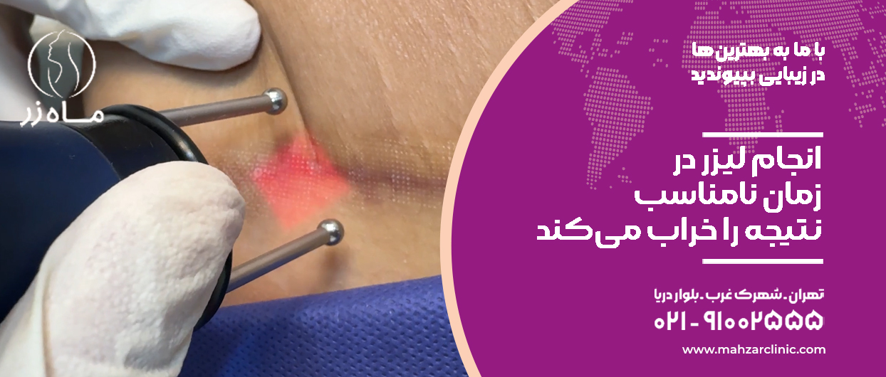انجام لیزر در زمان نامناسب نتیجه را خراب میکند