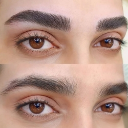 نمونه میکروبلیدینگ کرج